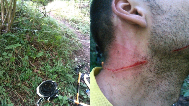 Велосипедисту чуть не оторвало голову на прогулке в Битцевском парке