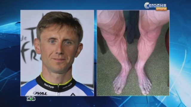 Польский велогонщик шокировал Интернет фотографией своих ног