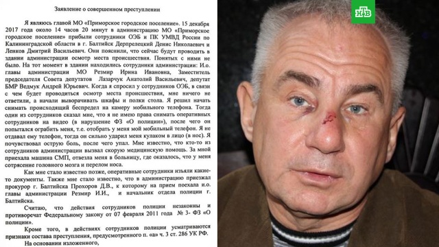 Глава Приморска заявил о нападении полицейского и сломанном носе: фото